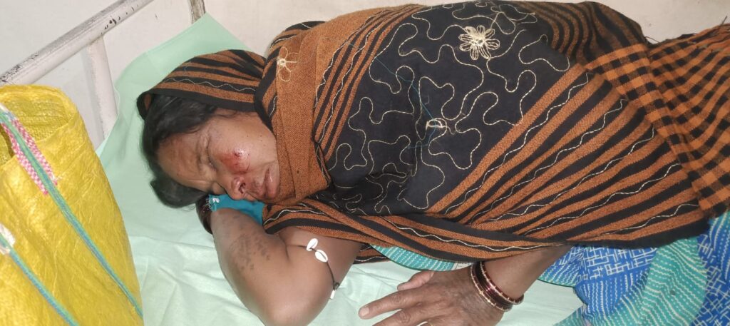 हाथी के हमले में महिला घायल, जंगल से लौट रहे ग्रामीणों पर अचानक हमला 3 1002136489