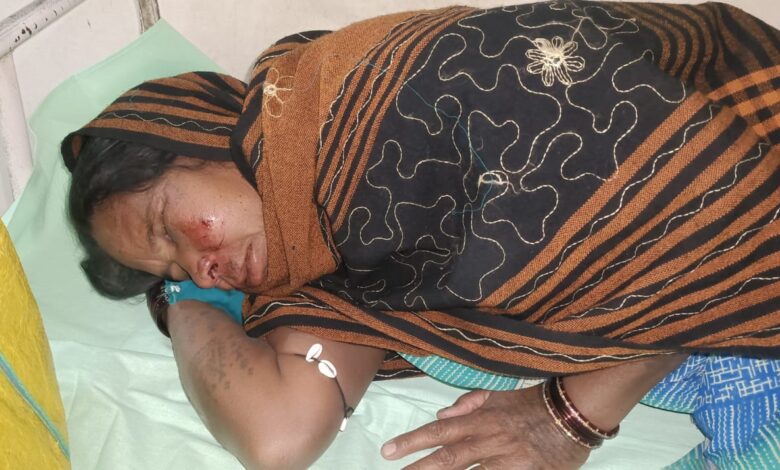 हाथी के हमले में महिला घायल, जंगल से लौट रहे ग्रामीणों पर अचानक हमला 1 IMG 20260323 WA0020